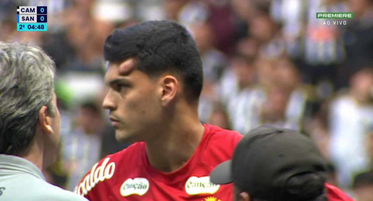 Ο σοκαριστικός τραυματισμός του τερματοφύλακα της Σάντος / Screenshot