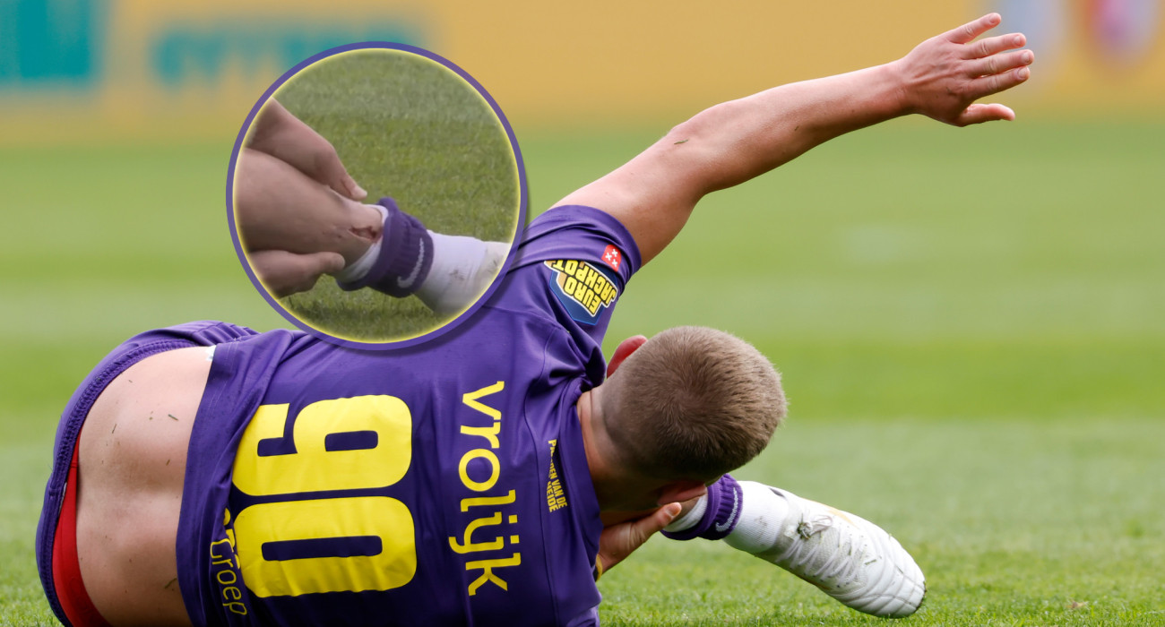 O Λιούις Χόλντι μόλις διαπίστωσε από που προήλθε ο οξής πόνος που ένοισε στην κνήμη του / Πηγή: Marcel van Hoorn / Getty Images