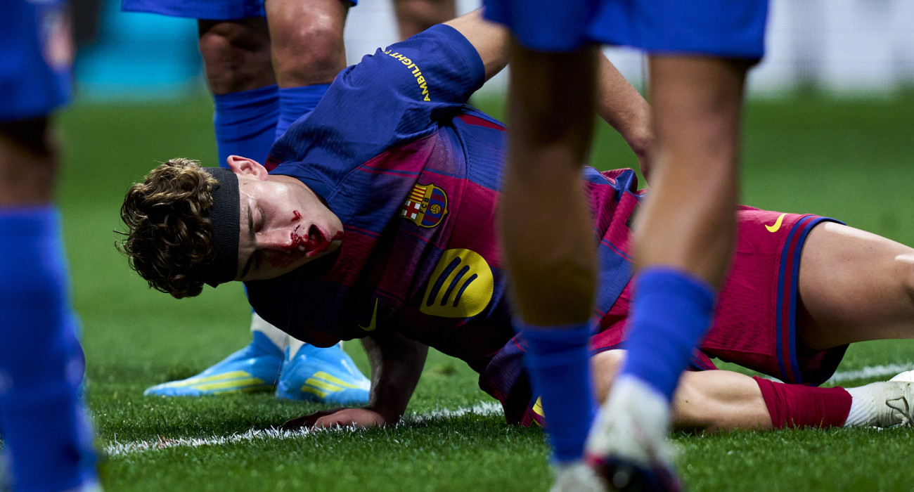 Γεμάτος αίματα στο χορτάρι ο Φερμίν Λόπεζ, Πηγή: Diego Souto/Getty Images/Ideal Images