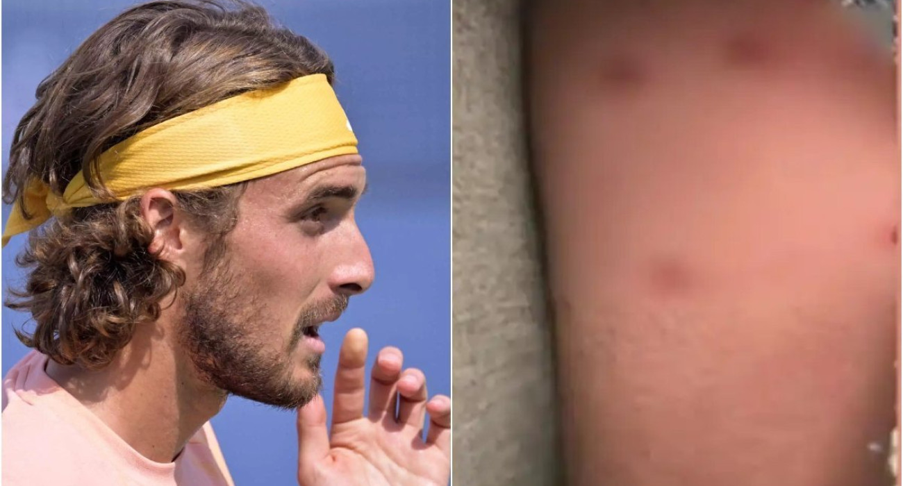 Ο σκύλος του Τσιτσιπά δάγκωσε περαστικό έξω από καφετέρια (video)