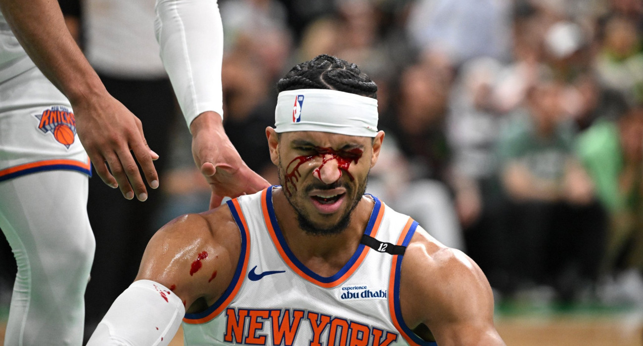 Ο τραυματισμός του Χαρτ στο ματς με τους Σέλτικς / Πηγή: Getty Images