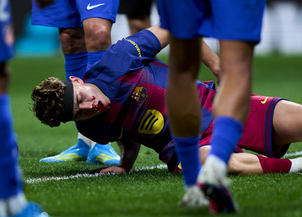 Τρομακτικός τραυματισμός του Φερμίν: Δέχθηκε χτύπημα στη μύτη και είχε ακατάσχετη αιμορραγία (video)