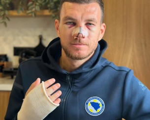 Τζέκο ο «μονομάχος» - Η τρομερή φωτογραφία του Βόσνιου μετά τον σοβαρό τραυματισμό του (pic & vid)