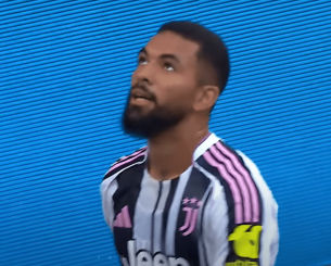 Ασταμάτητη Νότιγχαμ - Δικός της και ο Ντόουγκλας Λουίζ με 30 εκατομμύρια ευρώ από τη Γιουβέντους