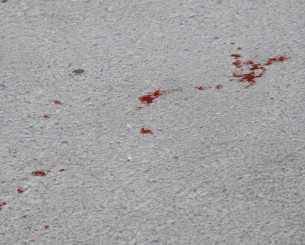 Χαλκίδα: Πήγαν τον 23χρονο με αγροτικό στο νοσοκομείο και τον παράτησαν απ' έξω