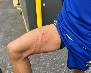 Ο Ρόουζ φωτογράφισε το πόδι του από τη «σκαριά» του Ιβανούσετς