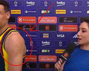 Αιχμές Μπόλντγουιν για τον Ολυμπιακό, έδειξε τις γρατζουνιές του on camera: «Αυτό είναι το παιχνίδι του...» (video)