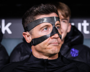 Τι είναι το «σύνδρομο Λεβαντόφσκι» το οποίο προκαλεί διπλή όραση