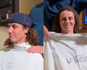 Στη μάχη με την φαλάκρα ο Νταβίντ Λουίζ δεν έπαιξε καλή άμυνα: «Δεν μπορώ να έχω πια τις μπούκλες μου»