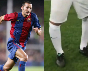 Το δράμα του Τζαμπρότα με το σοβαρό πρόβλημα στα πόδια