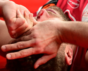 Αιμόφυρτος στα αποδυτήρια ο Βεζένκοφ - Έκανε τέσσερα ράμματα (photos)