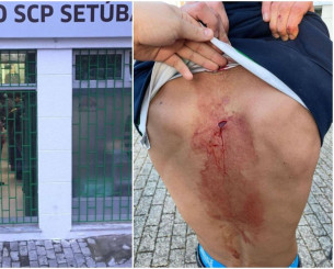 Σοκαριστικές εικόνες: Οπαδός της Σπόρτινγκ μαχαιρώθηκε από «ultras» της Μπενφίκα