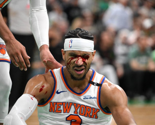 Η σοκαριστική φωτογραφία με το ματωμένο πρόσωπο του Χαρτ (pic)