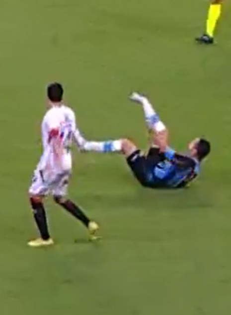 Σοκαριστικό: Παίκτης της Γκρέμιο διέλυσε τον αστράγαλο του και «πάγωσε» όλο το γήπεδο (video)