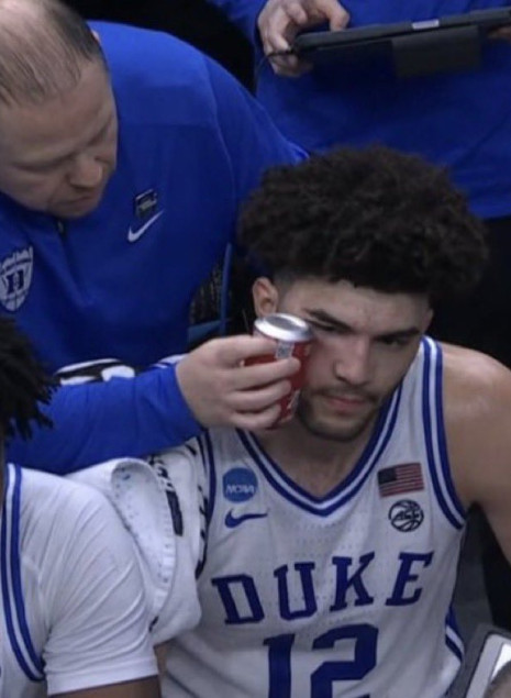 Το Ντιούκ έπαθε... Ελληνίδα μάνα: Χρησιμοποίησε κουτάκι αναψυκτικό για να φροντίσει τραυματισμό του Μπούζερ