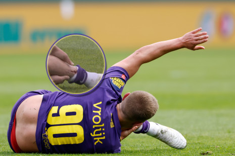 Επικίνδυνη μόδα: Να τι μπορεί να πάθεις αν δεν φοράς τις κατάλληλες επικαλαμίδες στο ποδόσφαιρο