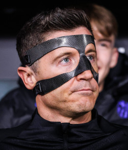 Τι είναι το «σύνδρομο Λεβαντόφσκι» το οποίο προκαλεί διπλή όραση