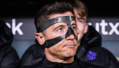 Τι είναι το «σύνδρομο Λεβαντόφσκι» το οποίο προκαλεί διπλή όραση