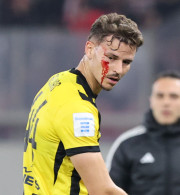 Δύο ματωμένα κεφάλια, μια υψωμένη γροθιά