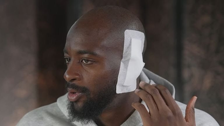 Σοκάρει ο Ματετά: «Το αυτί μου κρεμόταν, ο χειρουργός δεν μου το έδειξε»