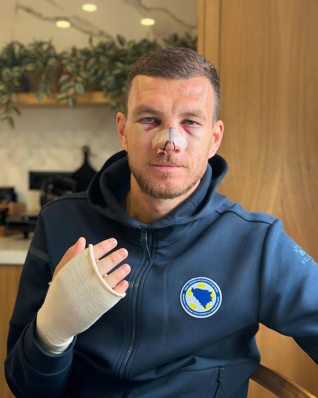 Τζέκο ο «μονομάχος» - Η τρομερή φωτογραφία του Βόσνιου μετά τον σοβαρό τραυματισμό του (pic & vid)