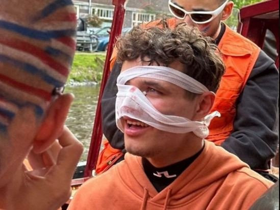 Ο σοκαριστικός τραυματισμός του Λάντο Νόρις - Ένας φωτογράφος παραλίγο να του σπάσει τη μύτη (video)