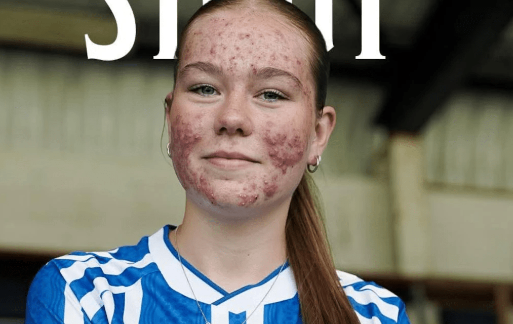 H 16χρονη Σκάι απάντησε στο bullying με γκολ στο ντεμπούτο της