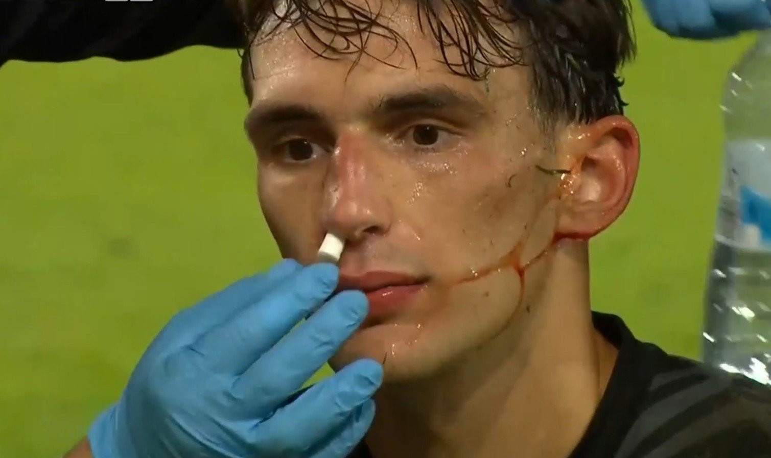 Η κατάθεση ψυχής του Μπότη: Δεν τον σταμάτησε ούτε το επικίνδυνο χτύπημα στο πρόσωπο (video)