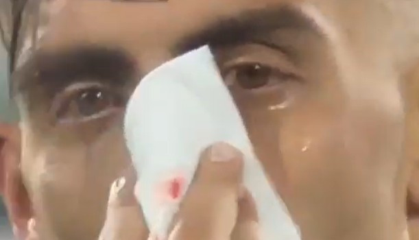 Απίστευτο: Ο γιατρός της Αλμπαθέτε παραλίγο να σπάσει τη μύτη του Μπετανκόρ στους πανηγυρισμούς (video)