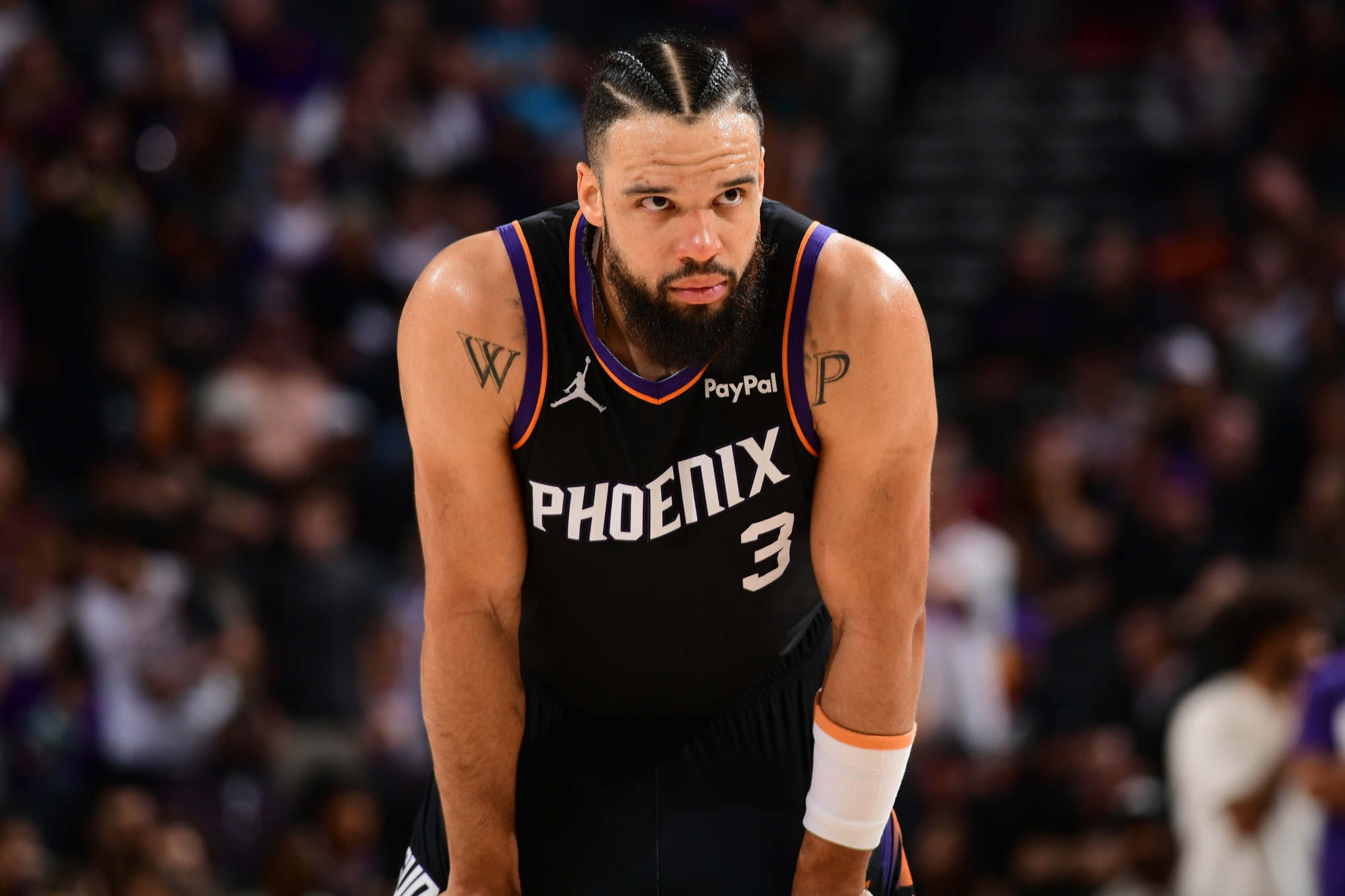 Ο Ντίλον Μπρουκς υπέστη κάταγμα στο αριστερό χέρι