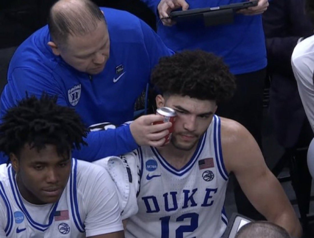 Το Ντιούκ έπαθε... Ελληνίδα μάνα: Χρησιμοποίησε κουτάκι αναψυκτικό για να φροντίσει τραυματισμό του Μπούζερ