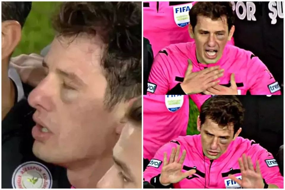 Ποιος είναι ο Τούρκος ρέφερι του ΑΕΚ - Ολυμπιακός που είχε πέσει θύμα ξυλοδαρμού