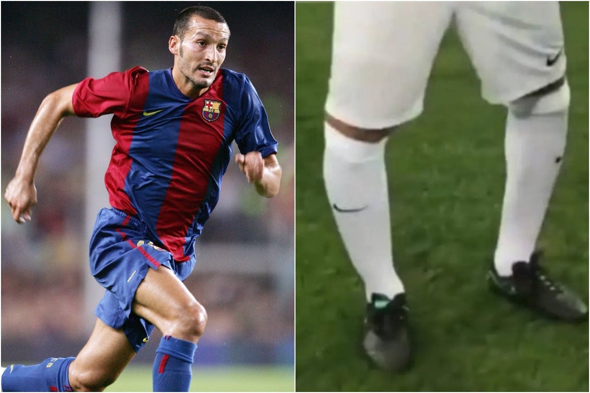 Το δράμα του Τζαμπρότα με το σοβαρό πρόβλημα στα πόδια