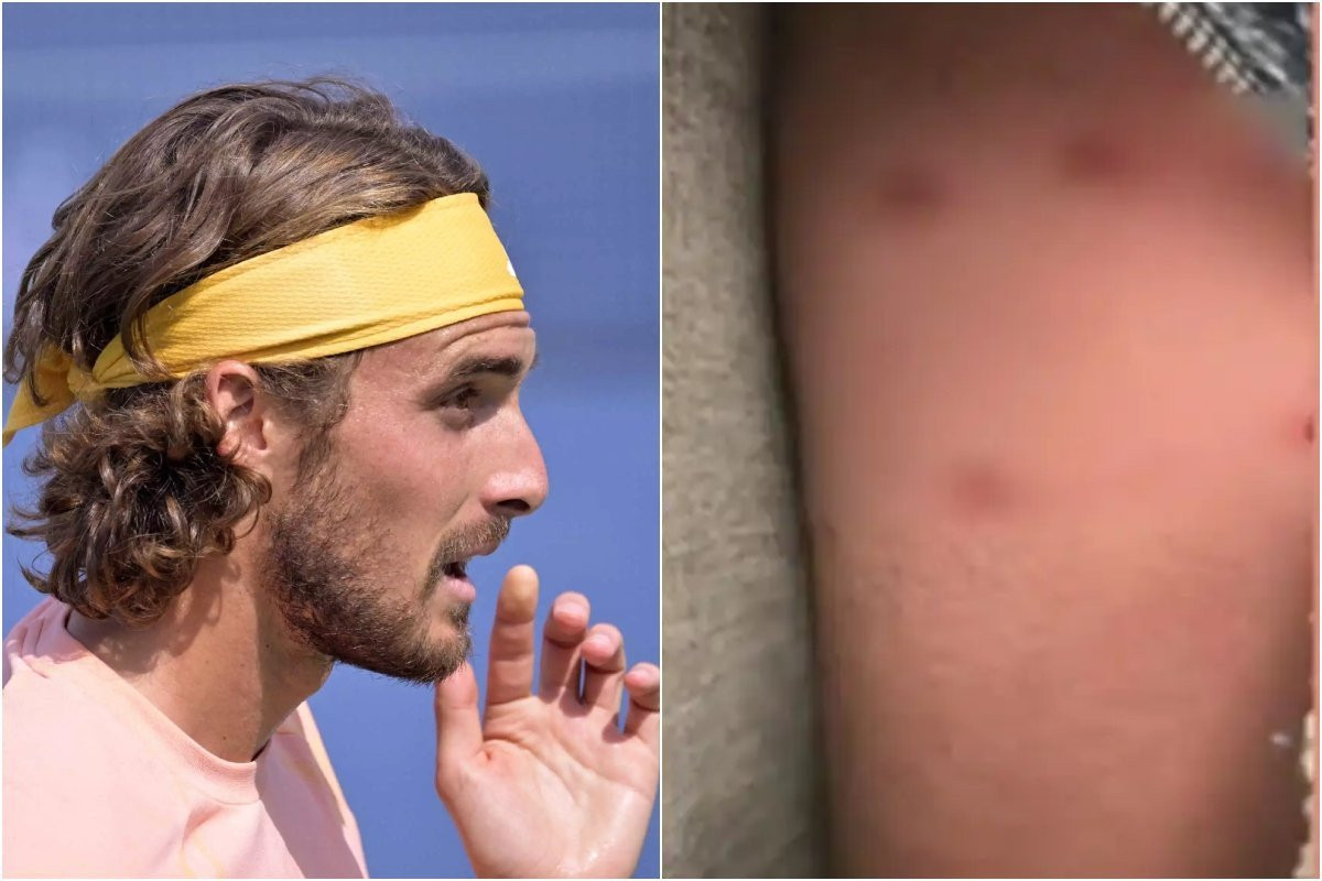 Ο σκύλος του Τσιτσιπά δάγκωσε περαστικό έξω από καφετέρια (video)