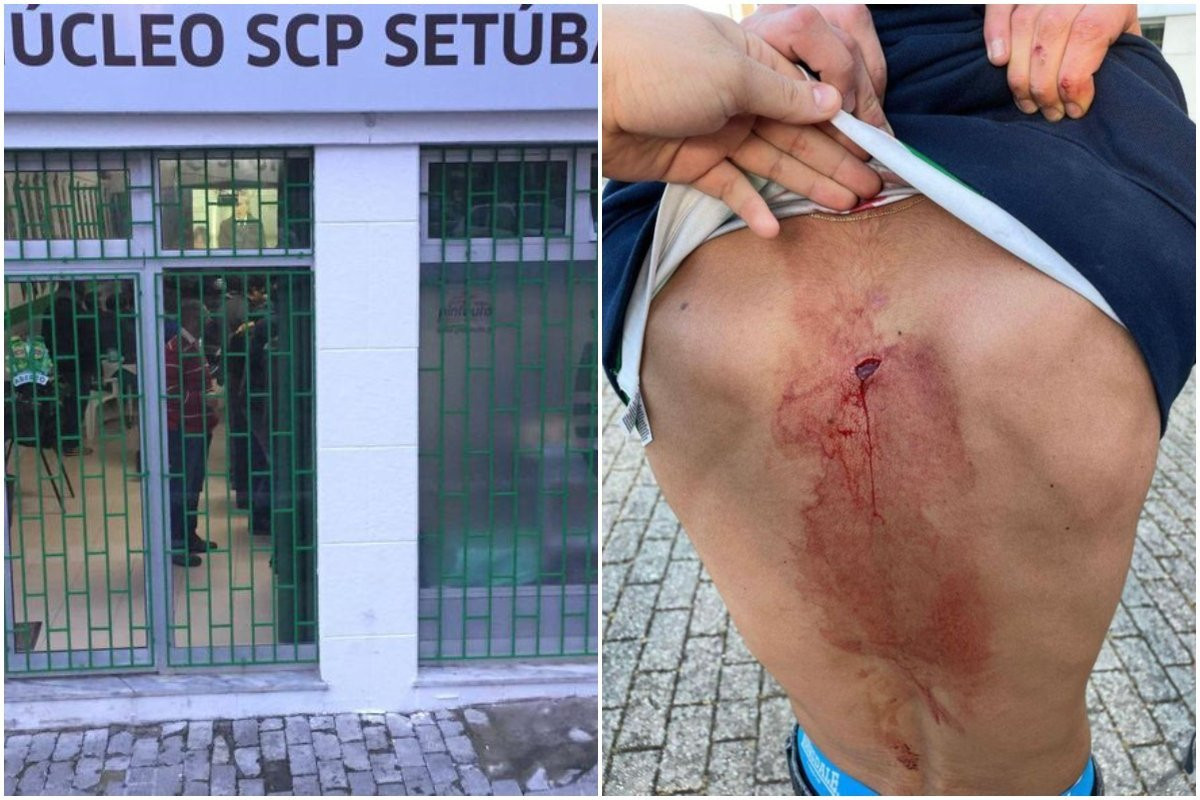 Σοκαριστικές εικόνες: Οπαδός της Σπόρτινγκ μαχαιρώθηκε από «ultras» της Μπενφίκα