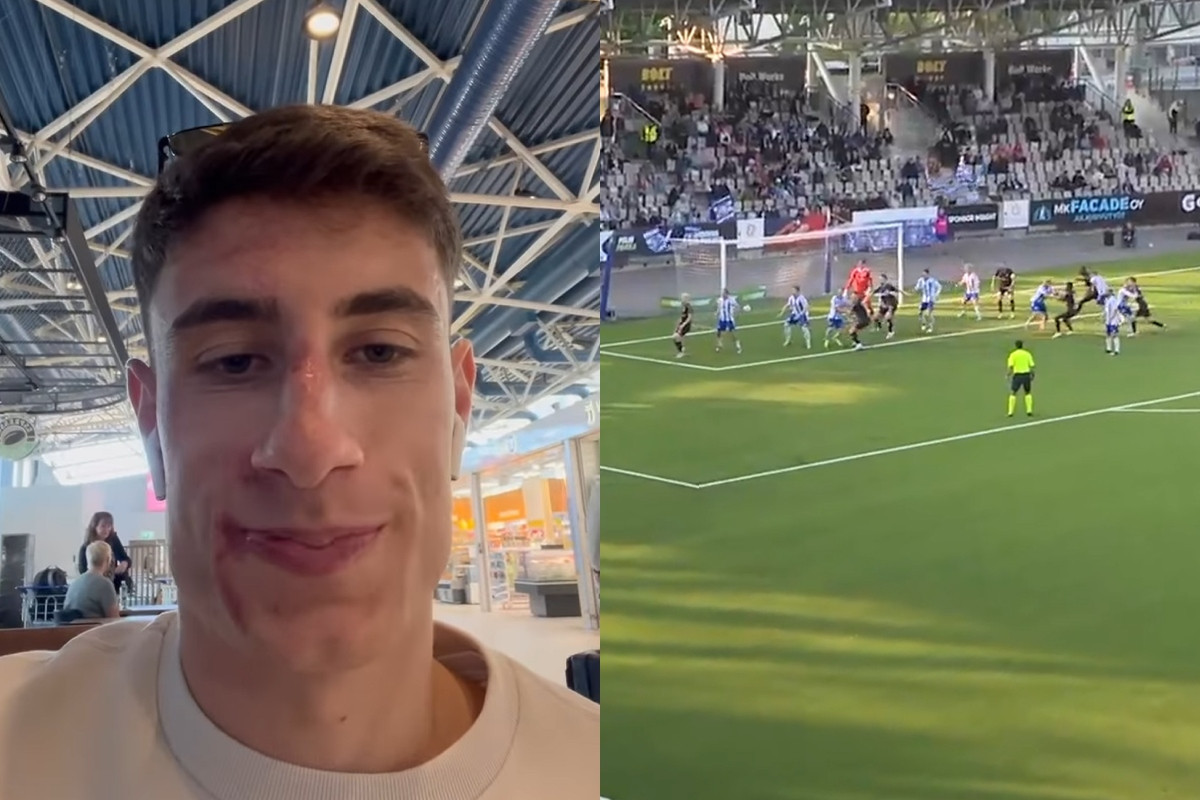 Σοκαριστικός τραυματισμός για τον Αντζουλά με την Ελσίνκι - Σάστισαν οι οπαδοί (video)