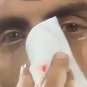 Απίστευτο: Ο γιατρός της Αλμπαθέτε χτύπησε τον Μπετανκόρ στη μύτη κατά τους πανηγυρισμούς (video)