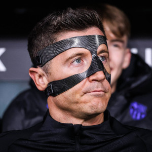 Τι είναι το «σύνδρομο Λεβαντόφσκι» το οποίο προκαλεί διπλή όραση