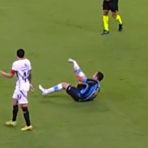 Σοκαριστικό: Παίκτης της Γκρέμιο διέλυσε τον αστράγαλο του και πάγωσε όλο το γήπεδο (video)